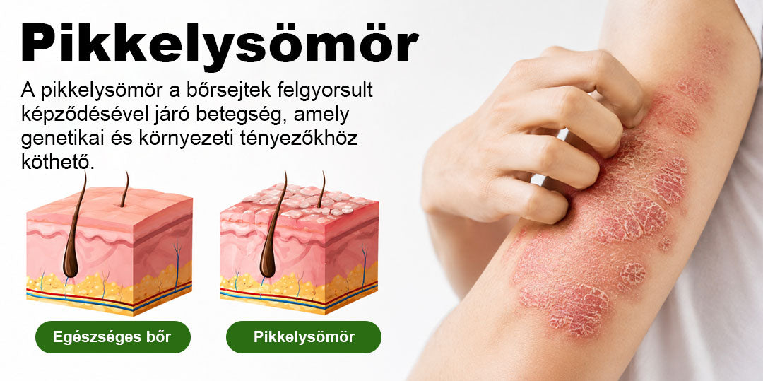 🌿 🌿Timilk® DermaOat növényi bőrbarrier-erősítő krém