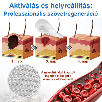 📌📌📌 Timilk® 2 az 1-ben mikrotűs és hidrokolloid tapasz | Kiemelkedő anyajegyek, pattanások, lapos szemölcsök és bőrkinövések eltávolítására | Segít javítani a ráncok, hegek és bőrhibák megjelenését | Láthatatlan pattanástapasz arcra és testre📌📌