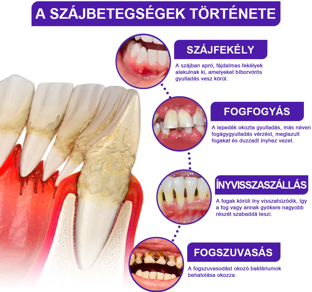 🌟A magyarok kedvence丨Rolimey® VioCore Méhméreg Fogkezelő Fogkrém