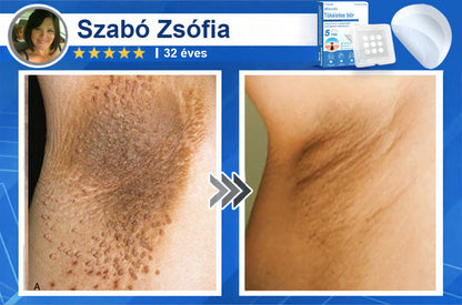 📌📌📌 Timilk® 2 az 1-ben mikrotűs és hidrokolloid tapasz | Kiemelkedő anyajegyek, pattanások, lapos szemölcsök és bőrkinövések eltávolítására | Segít javítani a ráncok, hegek és bőrhibák megjelenését | Láthatatlan pattanástapasz arcra és testre📌📌