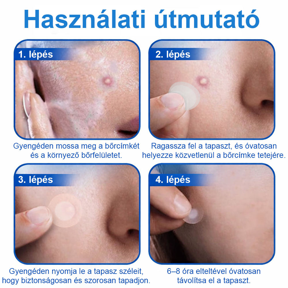 📌📌📌 Timilk® 2 az 1-ben mikrotűs és hidrokolloid tapasz | Kiemelkedő anyajegyek, pattanások, lapos szemölcsök és bőrkinövések eltávolítására | Segít javítani a ráncok, hegek és bőrhibák megjelenését | Láthatatlan pattanástapasz arcra és testre📌📌