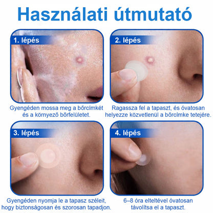 📌📌📌 Timilk® 2 az 1-ben mikrotűs és hidrokolloid tapasz | Kiemelkedő anyajegyek, pattanások, lapos szemölcsök és bőrkinövések eltávolítására | Segít javítani a ráncok, hegek és bőrhibák megjelenését | Láthatatlan pattanástapasz arcra és testre📌📌