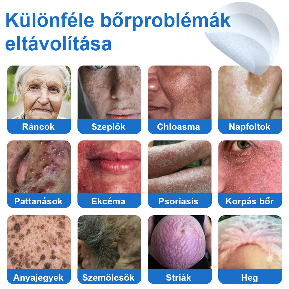 📌📌📌 Timilk® 2 az 1-ben mikrotűs és hidrokolloid tapasz | Kiemelkedő anyajegyek, pattanások, lapos szemölcsök és bőrkinövések eltávolítására | Segít javítani a ráncok, hegek és bőrhibák megjelenését | Láthatatlan pattanástapasz arcra és testre📌📌