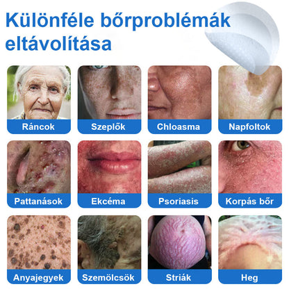 📌📌📌 Timilk® 2 az 1-ben mikrotűs és hidrokolloid tapasz | Kiemelkedő anyajegyek, pattanások, lapos szemölcsök és bőrkinövések eltávolítására | Segít javítani a ráncok, hegek és bőrhibák megjelenését | Láthatatlan pattanástapasz arcra és testre📌📌