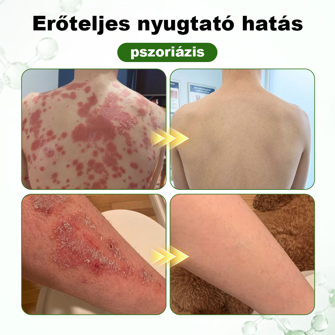 🌿 🌿Timilk® DermaOat növényi bőrbarrier-erősítő krém