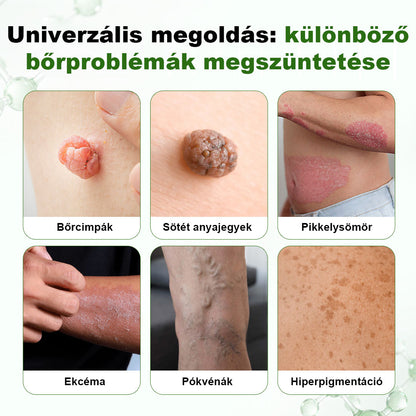 🌿 🌿Timilk® DermaOat növényi bőrbarrier-erősítő krém