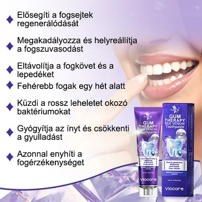 🌟A magyarok kedvence丨Rolimey® VioCore Méhméreg Fogkezelő Fogkrém