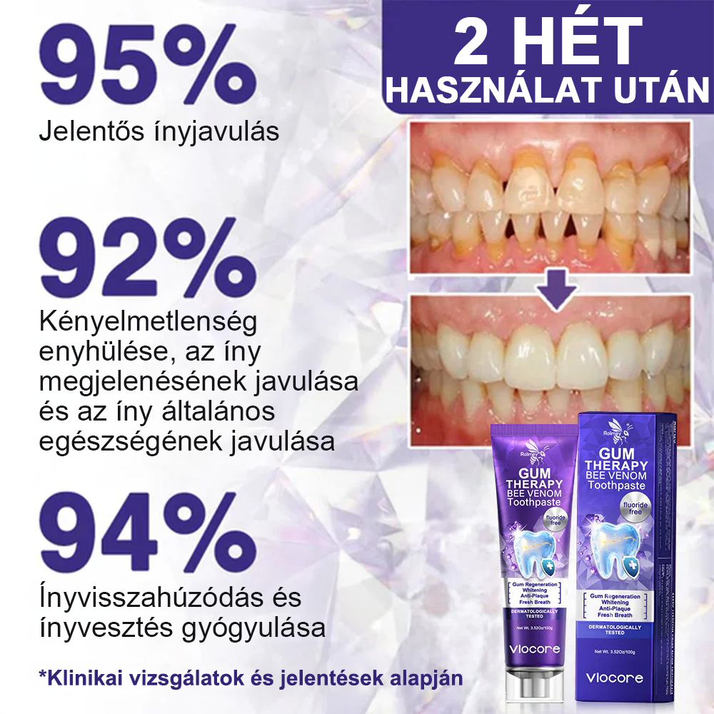 🌟A magyarok kedvence丨Rolimey® VioCore Méhméreg Fogkezelő Fogkrém