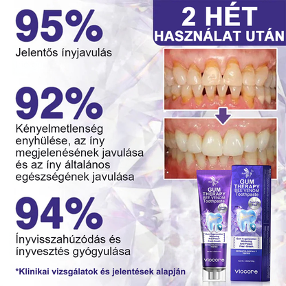 🌟A magyarok kedvence丨Rolimey® VioCore Méhméreg Fogkezelő Fogkrém