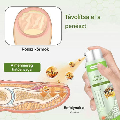 🔥A legnépszerűbb丨Korlátozott ideig 50%-os kedvezmény | Foulme® NailRescue Méhméreg Spray🐝