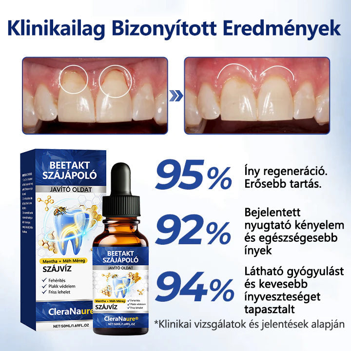 CleraNaure® BeeTakt Szájápoló Javító Oldat -🔥