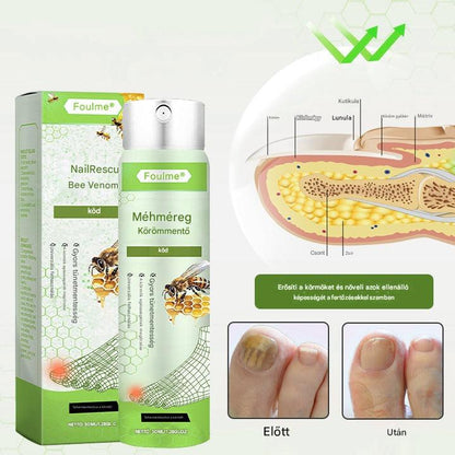 🔥A legnépszerűbb丨Korlátozott ideig 50%-os kedvezmény | Foulme® NailRescue Méhméreg Spray🐝