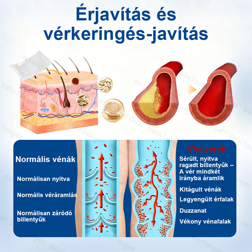 ✅Laleia® Vein Ease mikrotűs tapasz