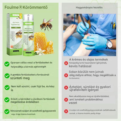 🔥A legnépszerűbb丨Korlátozott ideig 50%-os kedvezmény | Foulme® NailRescue Méhméreg Spray🐝