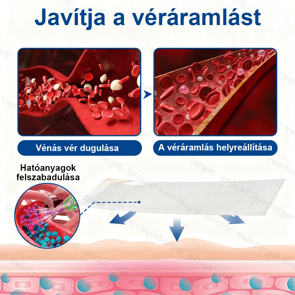 ✅Laleia® Vein Ease mikrotűs tapasz