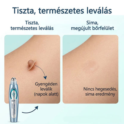 🖊🖊 Timilk® SpotlessPro Fejlett Bőrápoló Toll